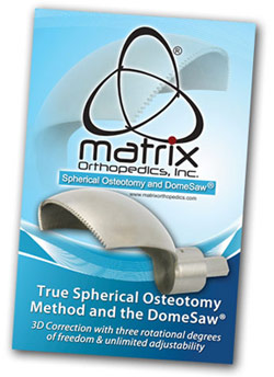 Matrix Orthopedics, Inc. Brochure